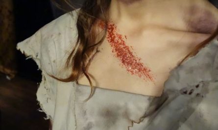 What does it mean to dream of bleeding?