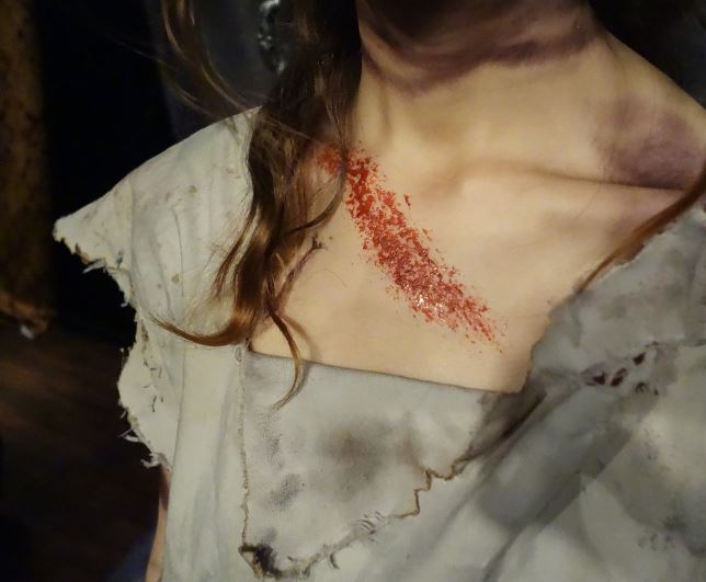 What does it mean to dream of bleeding?